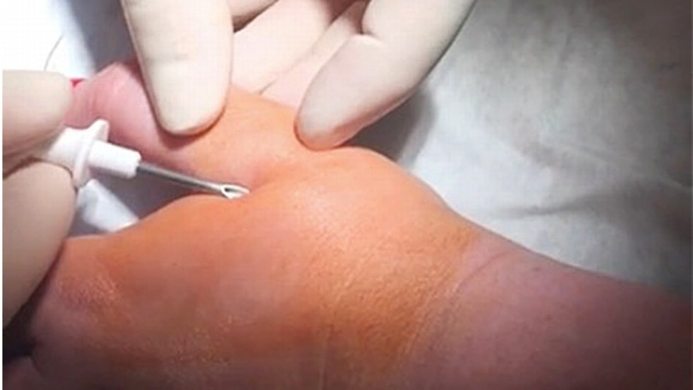 Swedes Will Pay for Christmas Gifts by Implanted Microchips This Year